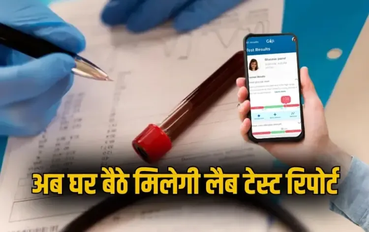 UP Lucknow Lab Test medical report SMS Whatsapp PHR Portal zxc