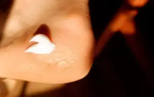 Cracked Heels Home Remedies