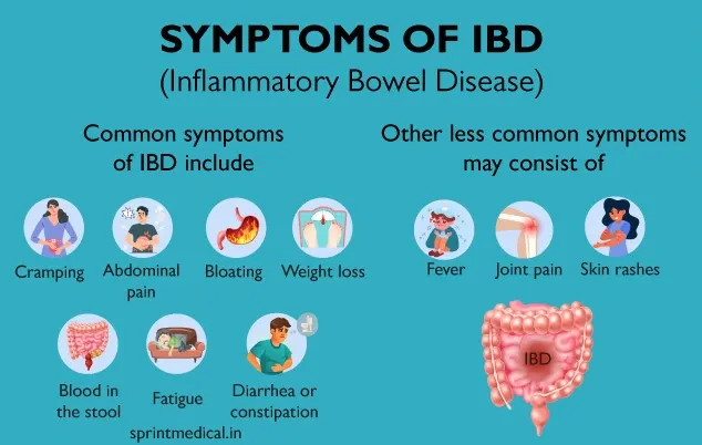 सूजन आंत्र रोग: लक्षण, कारण और उपचार | स्प्रिंट मेडिकल