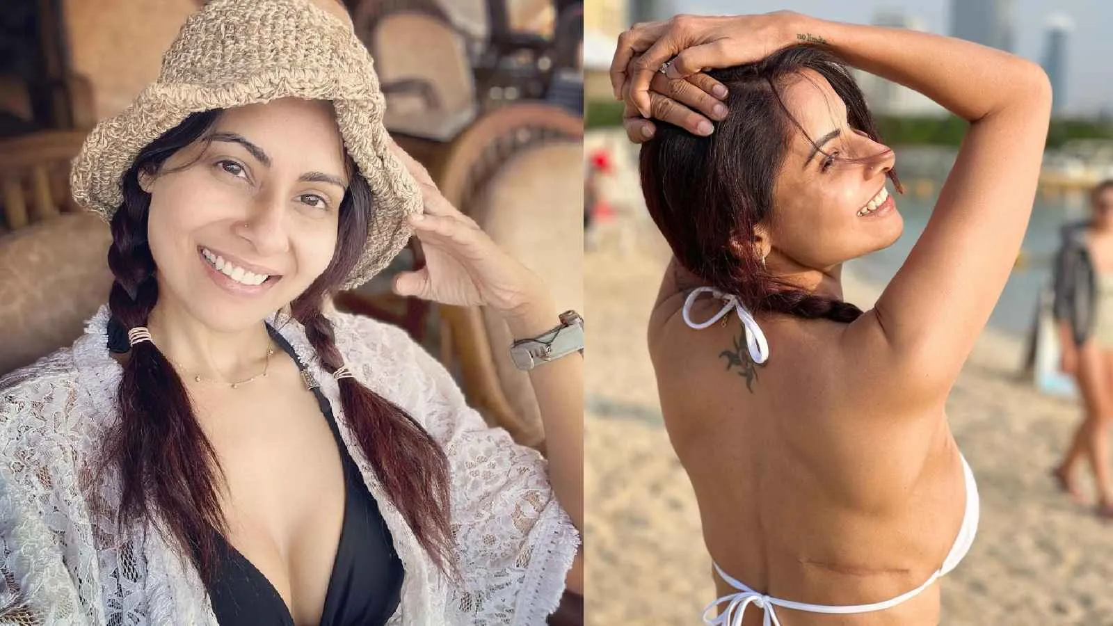 Chhavi Mittal: My breast surgery scars are my battle scars, I'm proud of them | HealthShots