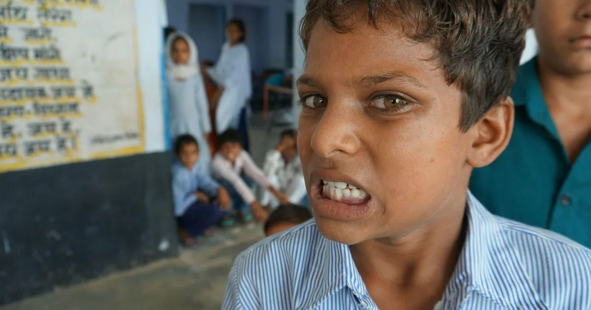 Fluorosis challenge: In Mewat, a radio station is helping spread awareness about the disease