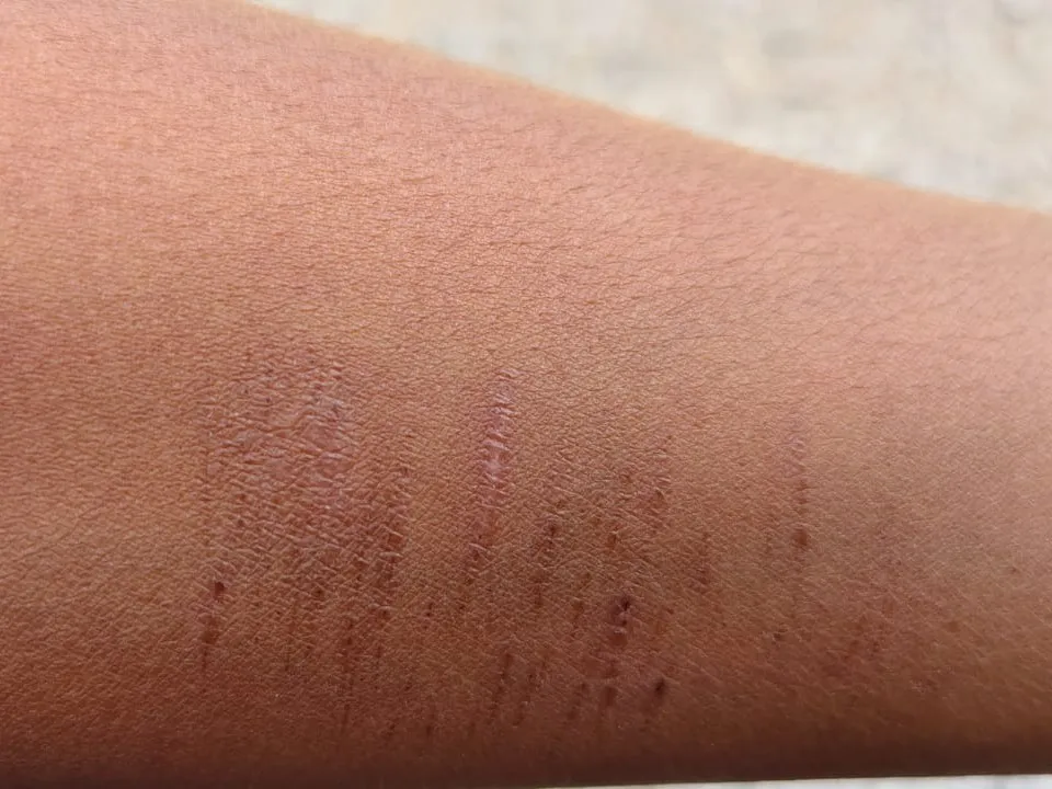 एक एक बच्चों के हाथ में 15-20 कट के निशान थे।