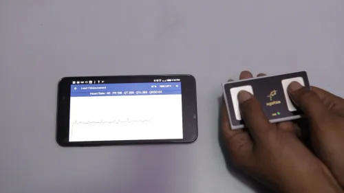 SANKET ECG