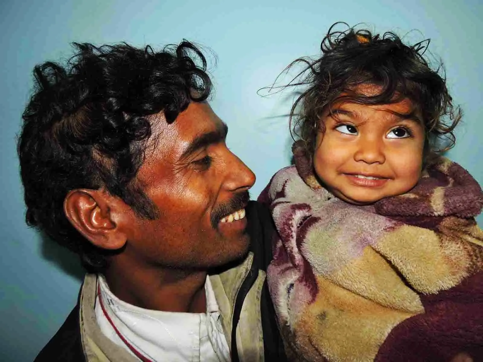2-year-old Kanika, a beneficiary of the Akhand Jyoti Eye Hospital