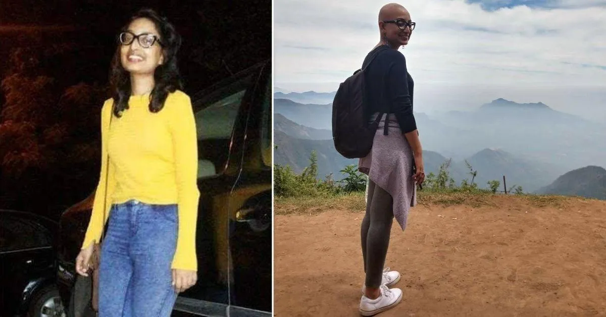 ‘My Alopecia Is Not a Joke’: Bengaluru-based Paromita Shares What Living With This Condition is Like