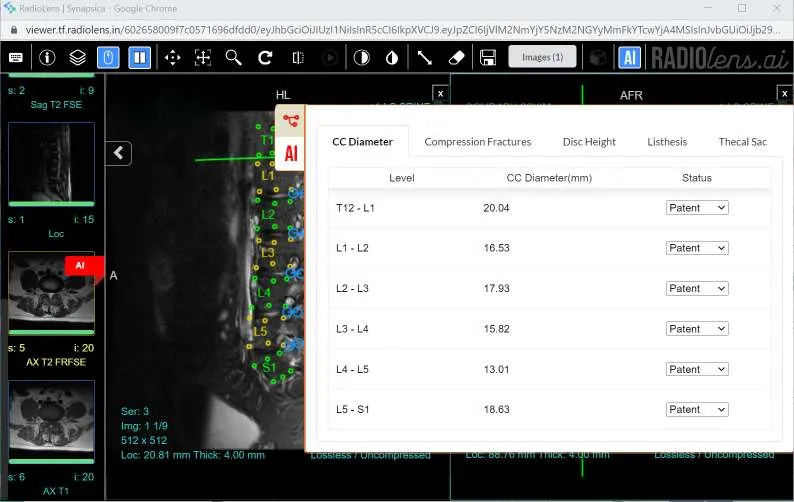 publive-image