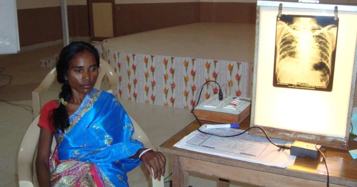 Silicosis is an incurable lung disease caused by the inhalation of dust containing silica crystals.