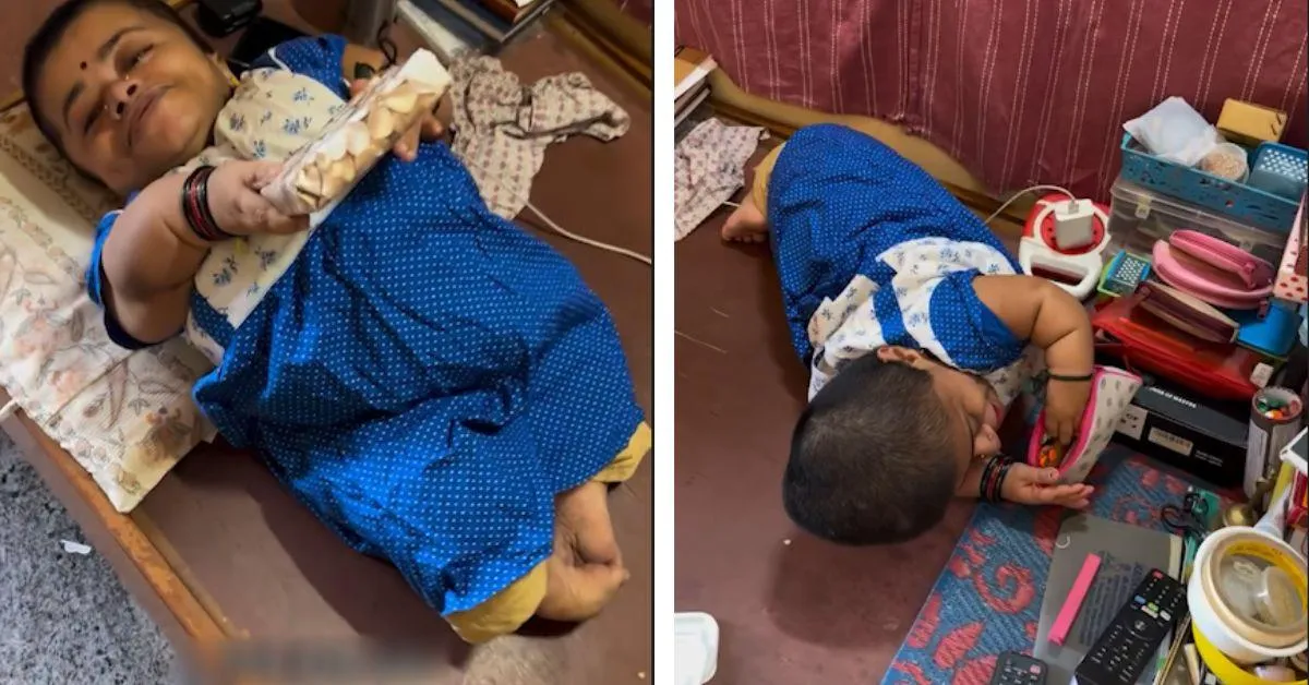 Girija was born with Osteogenesis Imperfecta (OI), a rare genetic disorder that makes bones extremely fragile and prone to breaking. 