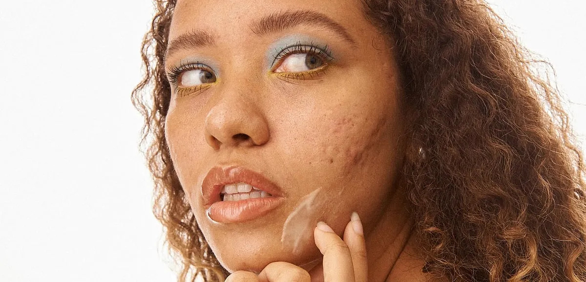 Gen Z-founded brand, Topicals,  promises ‘skincare for funner flare-ups.’ 