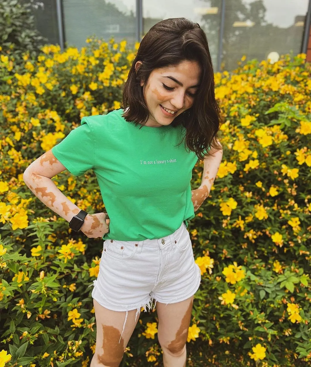 Rhea AgarwalIf you have vitiligo, until a few years ago, it was hard to find people on social media that looked like you. Rhea Agarwal, an influencer and model, has been using Instagram to educate her audience about her skin condition, and regularly posts about self-acceptance and her journey to get there. “You can still have fun with vitiligo, you can still get a job, you can still fall in love,” she says in a post. 