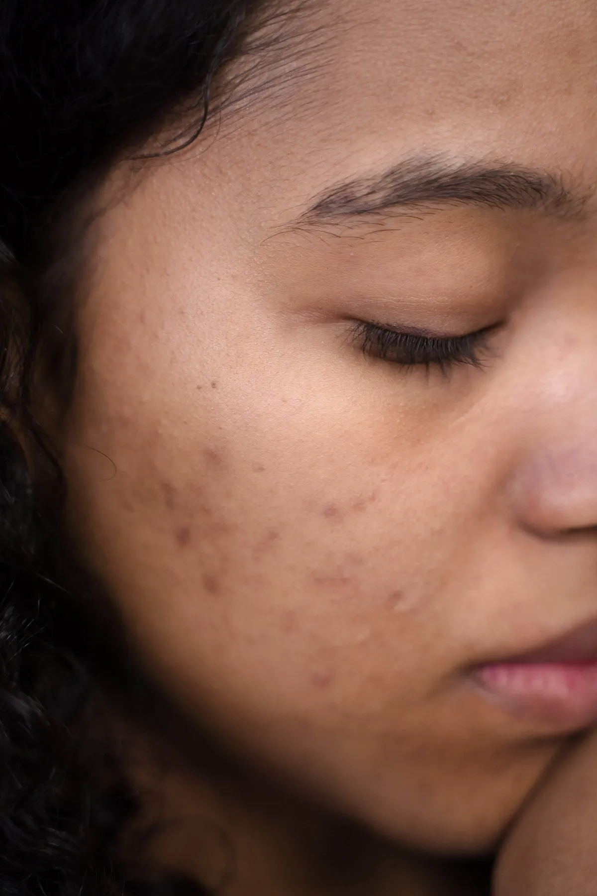 With more and more attention being paid to the skin barrier (and the layers beneath), the surface-level appearance of your skin isn’t the dealbreaker anymore. Image: Pexels 