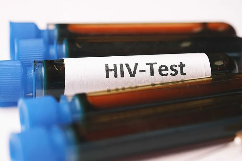 The stigma within the community for HIV-positive people takes many forms, even resulting in some of them internalising guilt and hate. Image: Pexels 