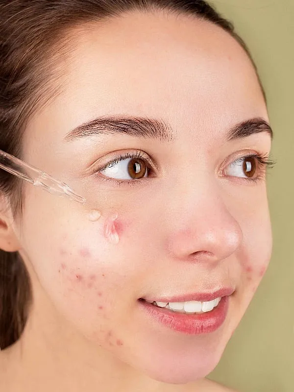 Vitamin C helps with battling hyperpigmentation, sun damage, dark spots and an uneven skin tone. Image: Pexels 