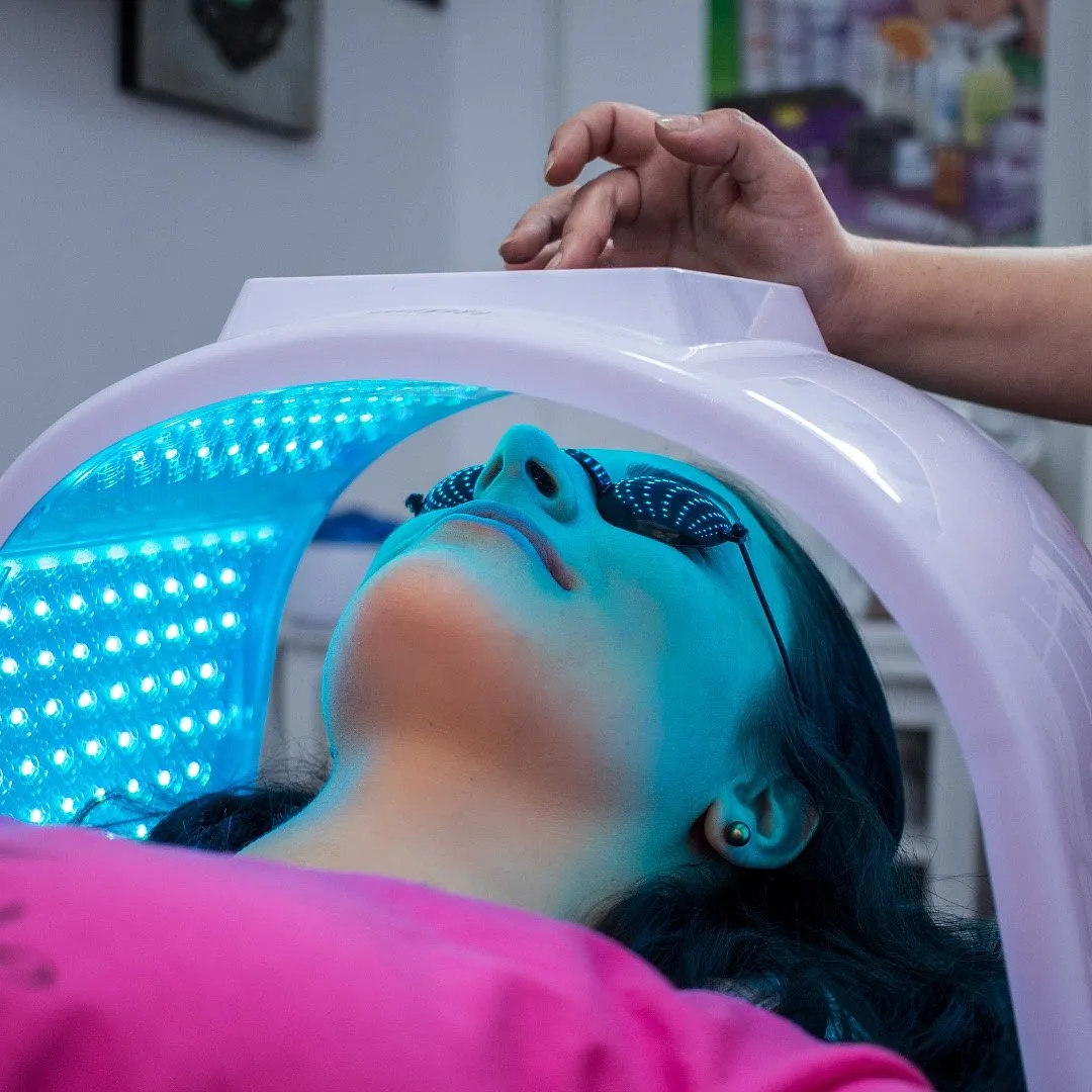 “If you have active skin infections, sunburn, or open wounds, it’s best to avoid the treatment until your skin has healed completely,” suggests Dr Kiran Sethi. Image: Pexels 