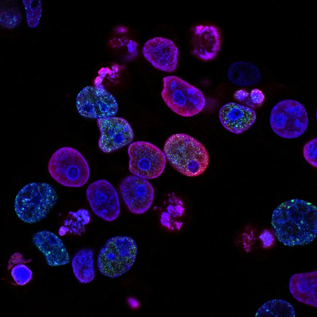 Broadly speaking, there are three categories of carcinogens—chemicals that can cause cancer (direct-acting carcinogens), chemicals that do not cause cancer unless they are changed when metabolised (procarcinogens), and chemicals that do not cause cancer by themselves but can act with another chemical to cause cancer (co-carcinogens), states a report. Image: Unsplash 
