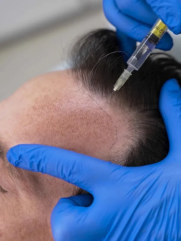 PRP therapy “involves the collection of one’s own blood, centrifugation and collection of platelet-rich plasma,” says Dr Jaishree Sharad. Image: Freepik 