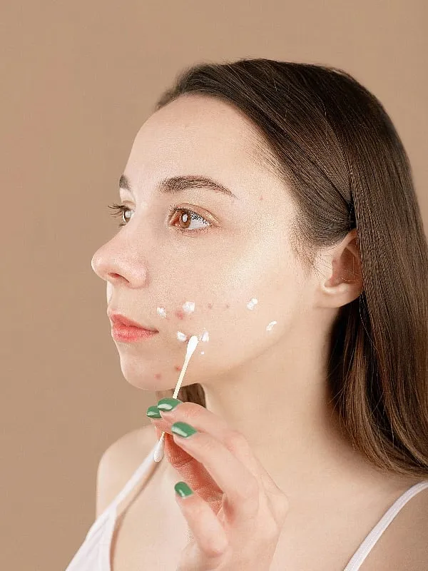 Purging happens with specific ingredients that are exfoliant in nature, such as AHAs, BHAs and retinols, says Dr Kiran Sethi. Image: Pexels 
