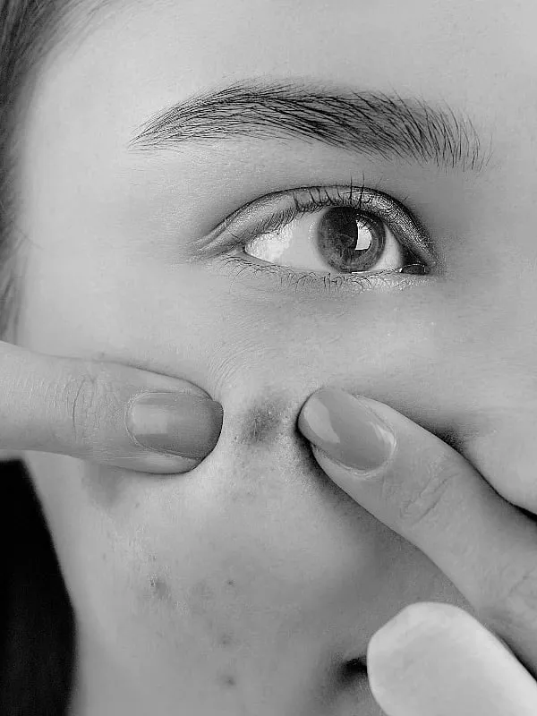 Skincare products can also cause breakouts or acne when you use products that aren’t suited for your particular skin type, says Mumbai-based dermatologist Dr Jaishree Sharad. Image: Pexels 