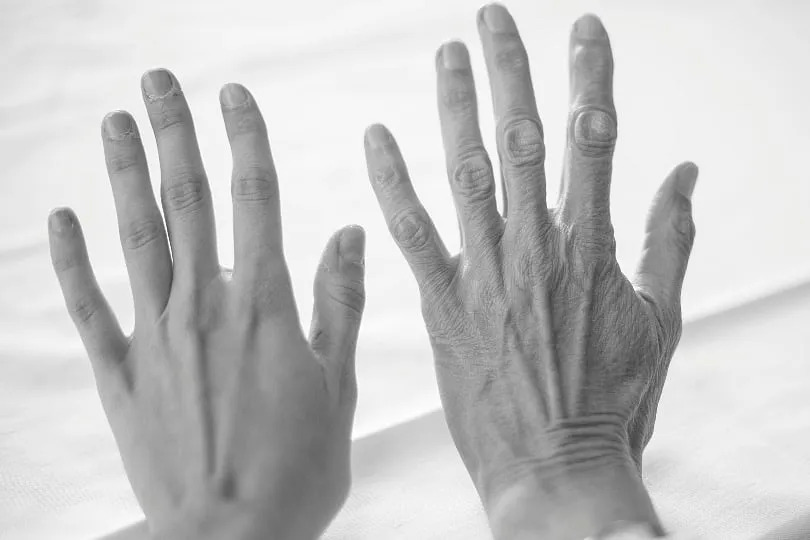 “The constant narrative around ‘anti-ageing’ is further driving young, impressionable minds closer to being victims of the same,” opines Suchitra Ghosh. Image: Pexels 