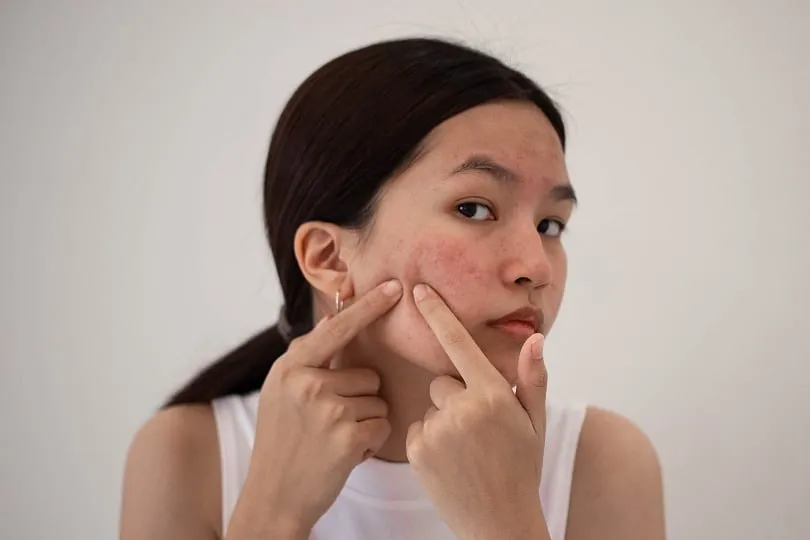 Adjusting one's diet can play a crucial role in the treatment of various skin conditions including rosacea, acne, psoriasis, ageing skin, and atopic dermatitis. Image: Unsplash 