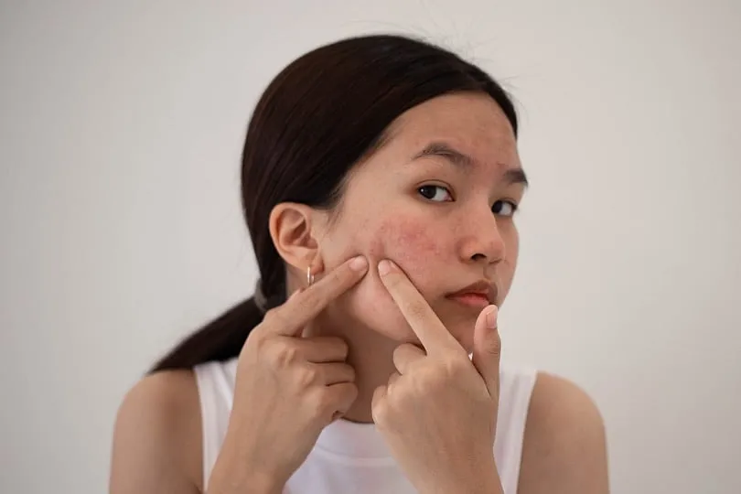For sensitive skin, fragrance free products may help to prevent flare-ups. Image: Pixabay 