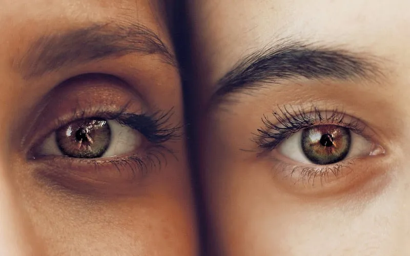Common causes of the non-pigmented dark circles include genetics, ageing and lifestyle habits. Factors like sleep deprivation, dehydration, and dietary deficiencies can further darken the under-eye area. Image: Pexels 
