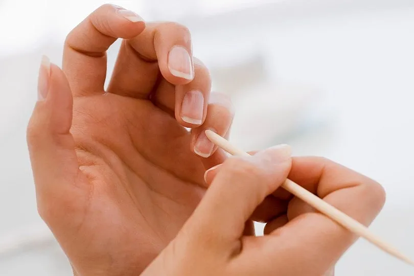 The cuticle is the skin barrier around your nails, warding off foreign particles and microbes from entering and lodging into the delicate nail pocket. Image: Pixabay 