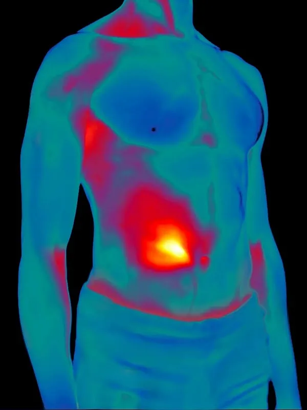 Inflammation is “a blanket term for the body’s response to any injury or harm,” says Dr Sandeep Yadav. Image: Pexels  