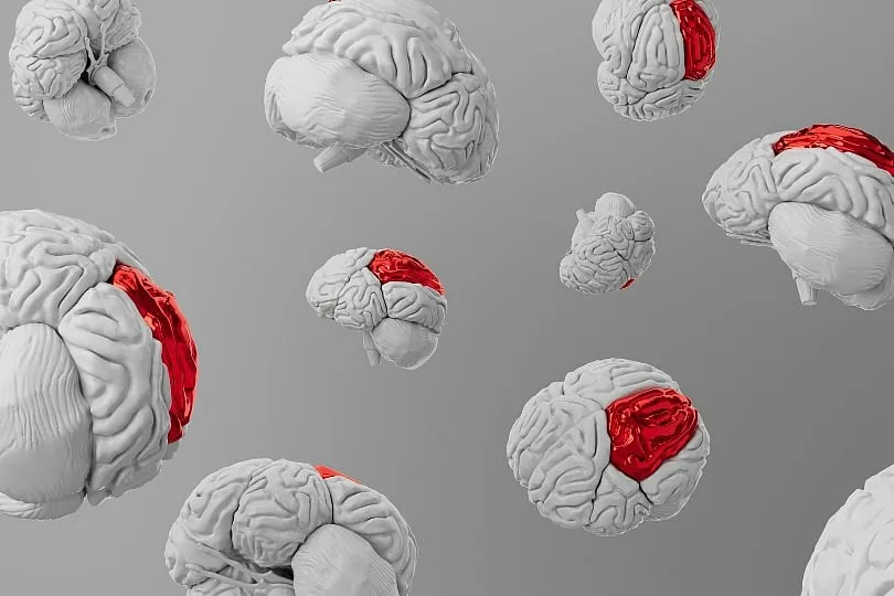 Cognitive decline can begin anytime after your midlife, however, at the age of 60 is usually when it occurs. Image: Pexels 
