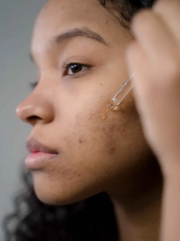 As the bacteria multiply and cause further irritation, your body’s immune system jumps into action to fight the infection. Image: Pexels 