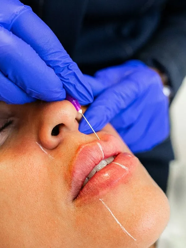 When you locally inject Botox into the facial muscles, you’re blocking the activity of that muscle, explains Dr Kiran Sethi. Image: Unsplash 