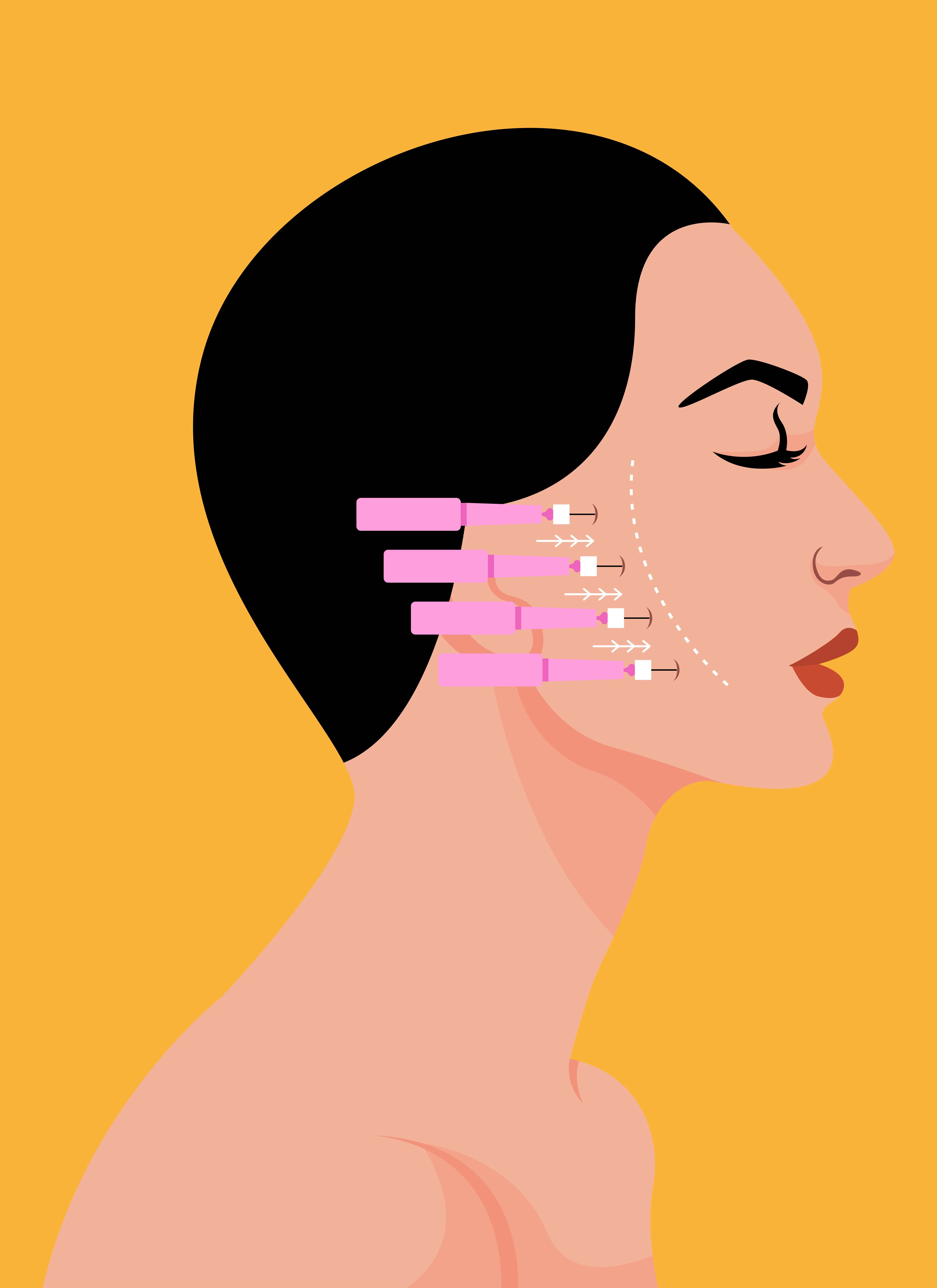 A graphical representation of needles in a woman's face for cosmetic work