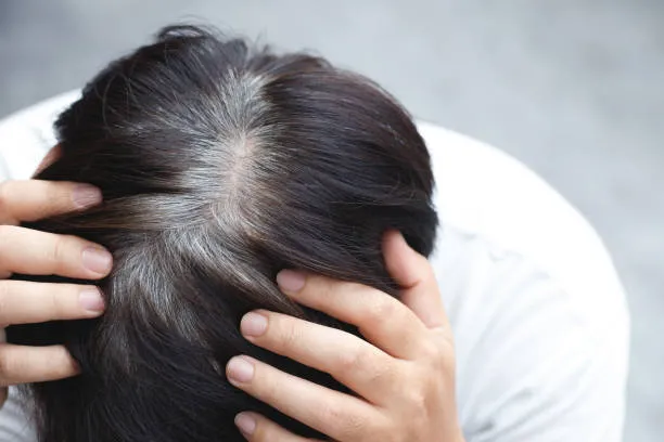 grey hair