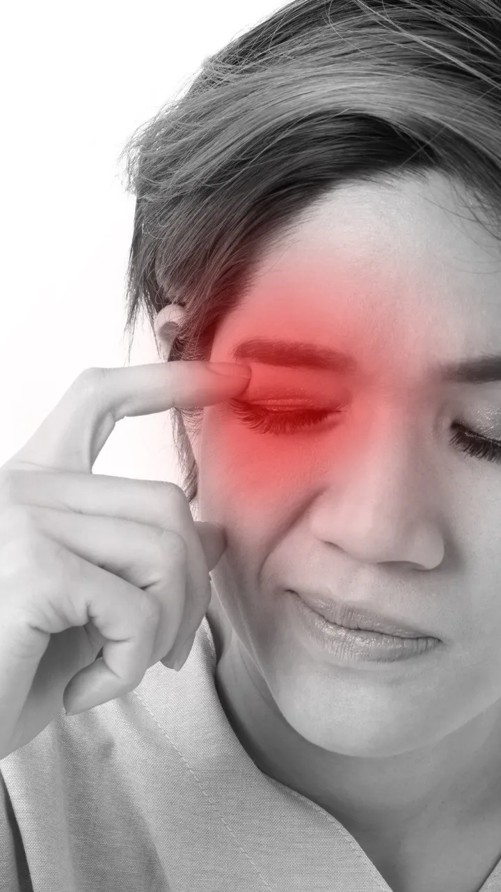 Eyelash dandruff 1