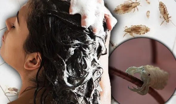 lice treatment
