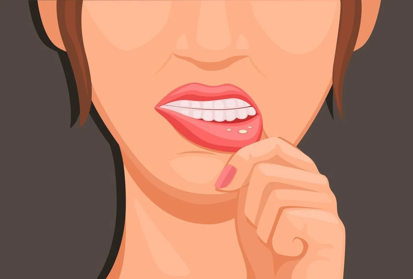 -lips-sprue-symptoms