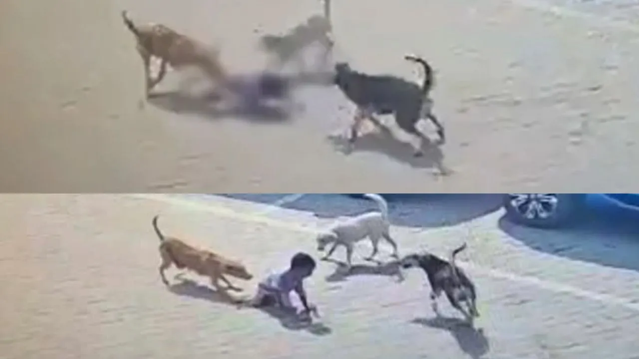 Stray Dogs Attacked 3 years old boy