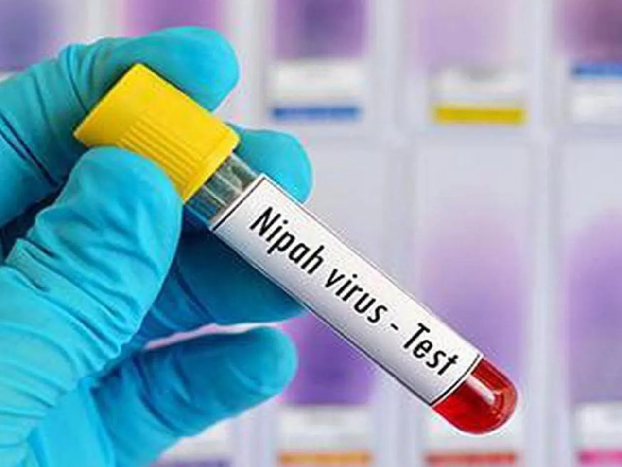 nipah virus test