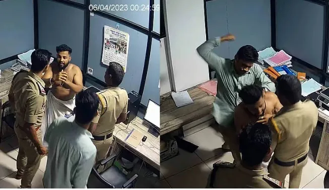 police attack