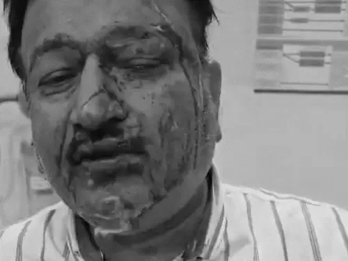 Ambikapur 20 lakhs robbery