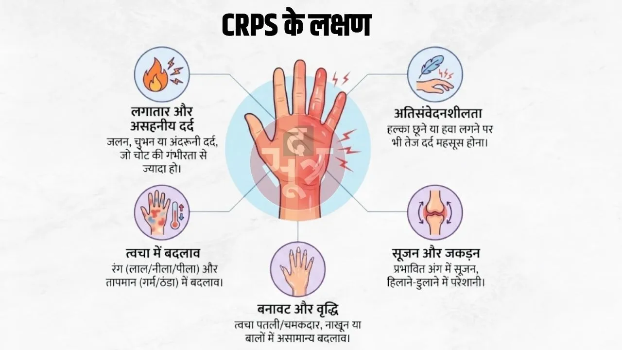 Symptoms of CRPS