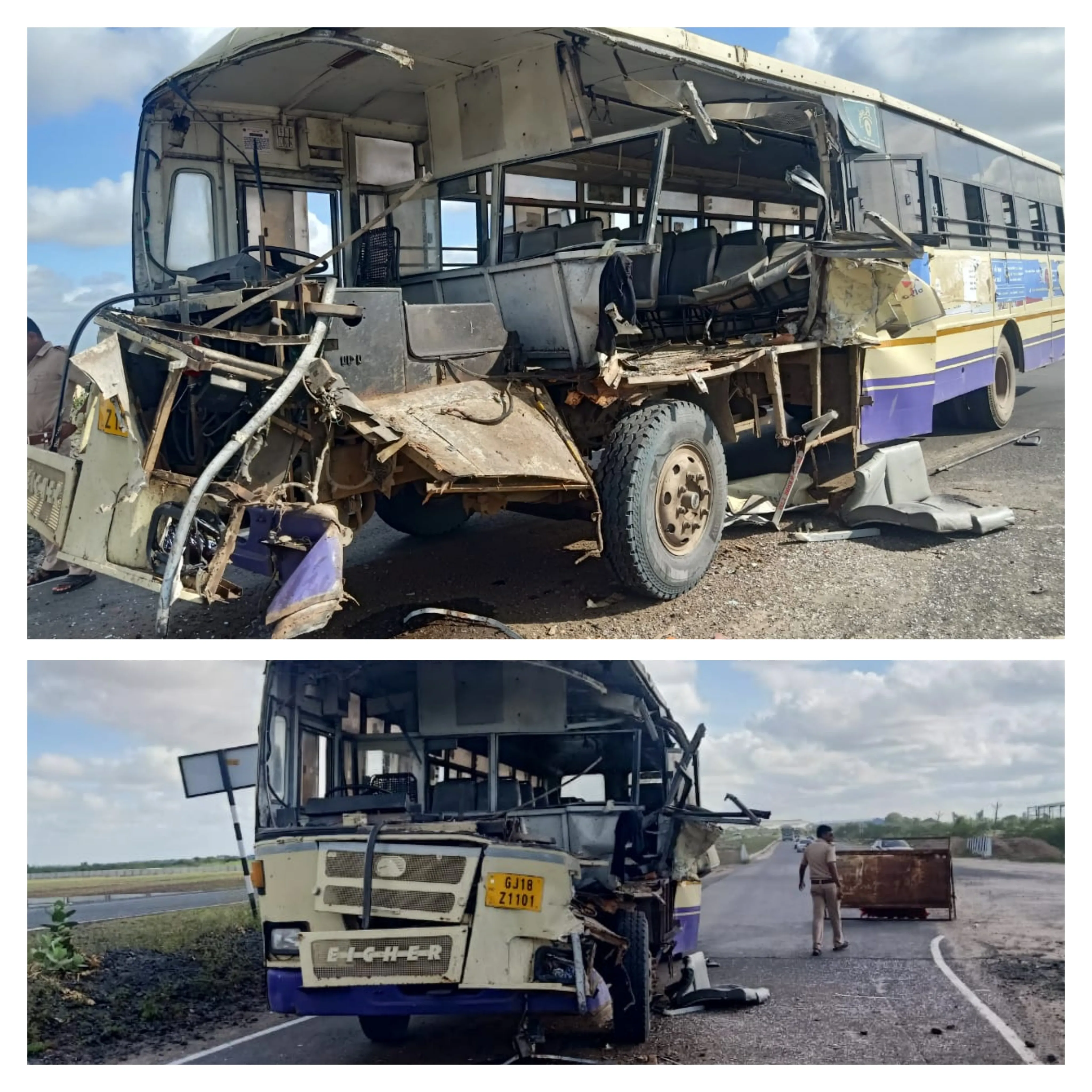 The bus accident in which Neha lost her one leg