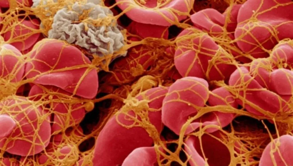 Representative image of Platelet Count