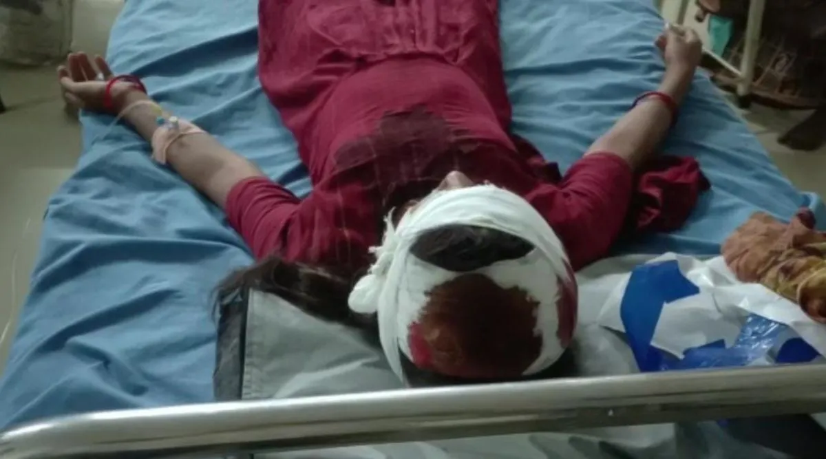 leopard attacked on girl