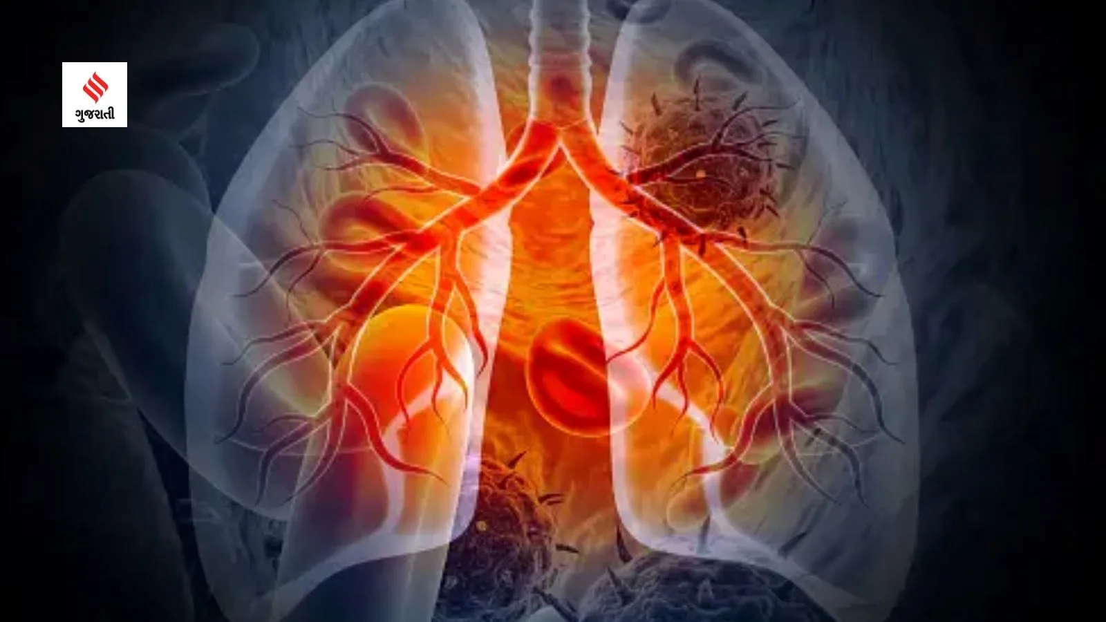 importance History awareness tuberculosis symptoms signs health tips in gujarati