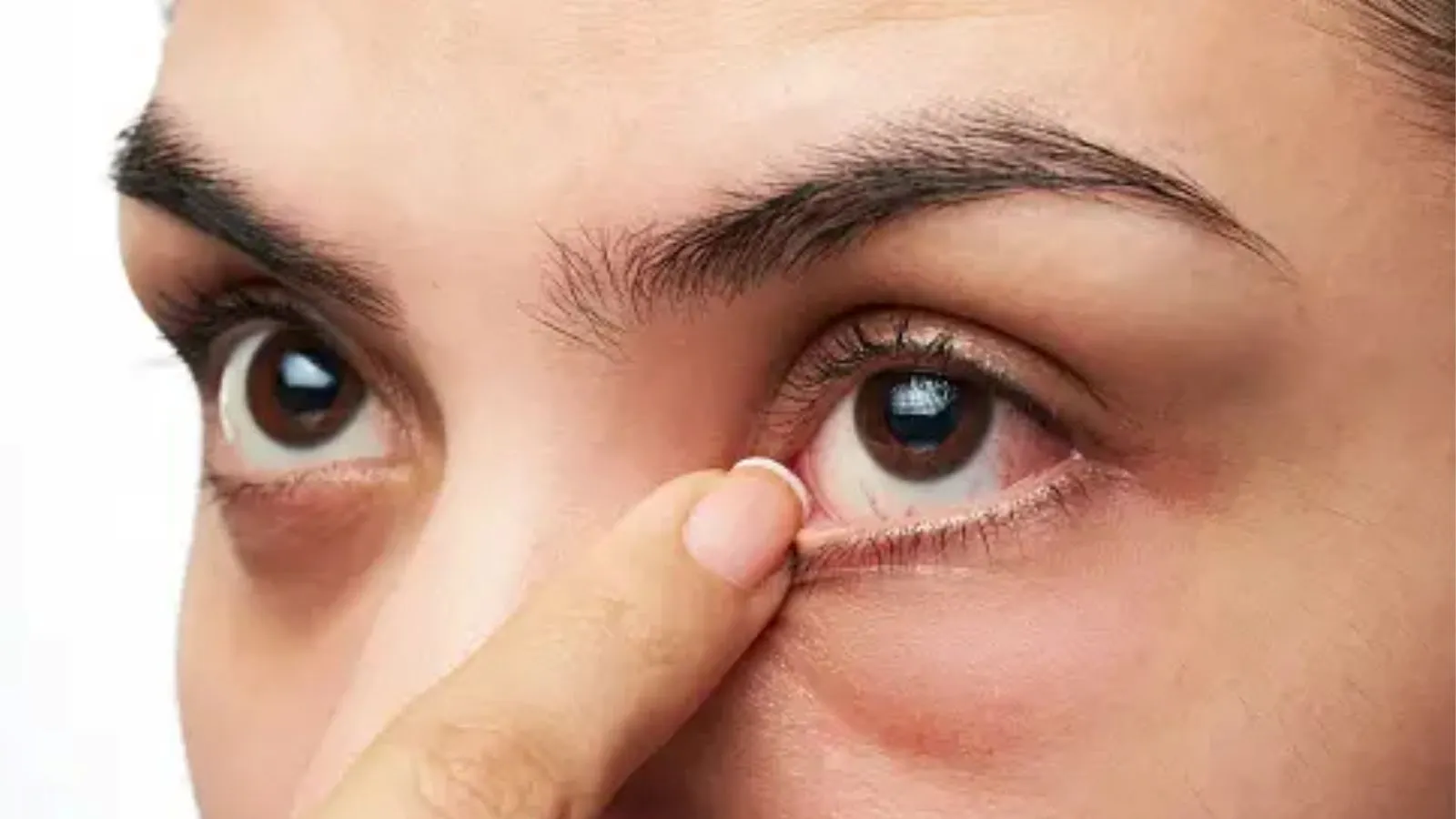 importance of hydration for eye health