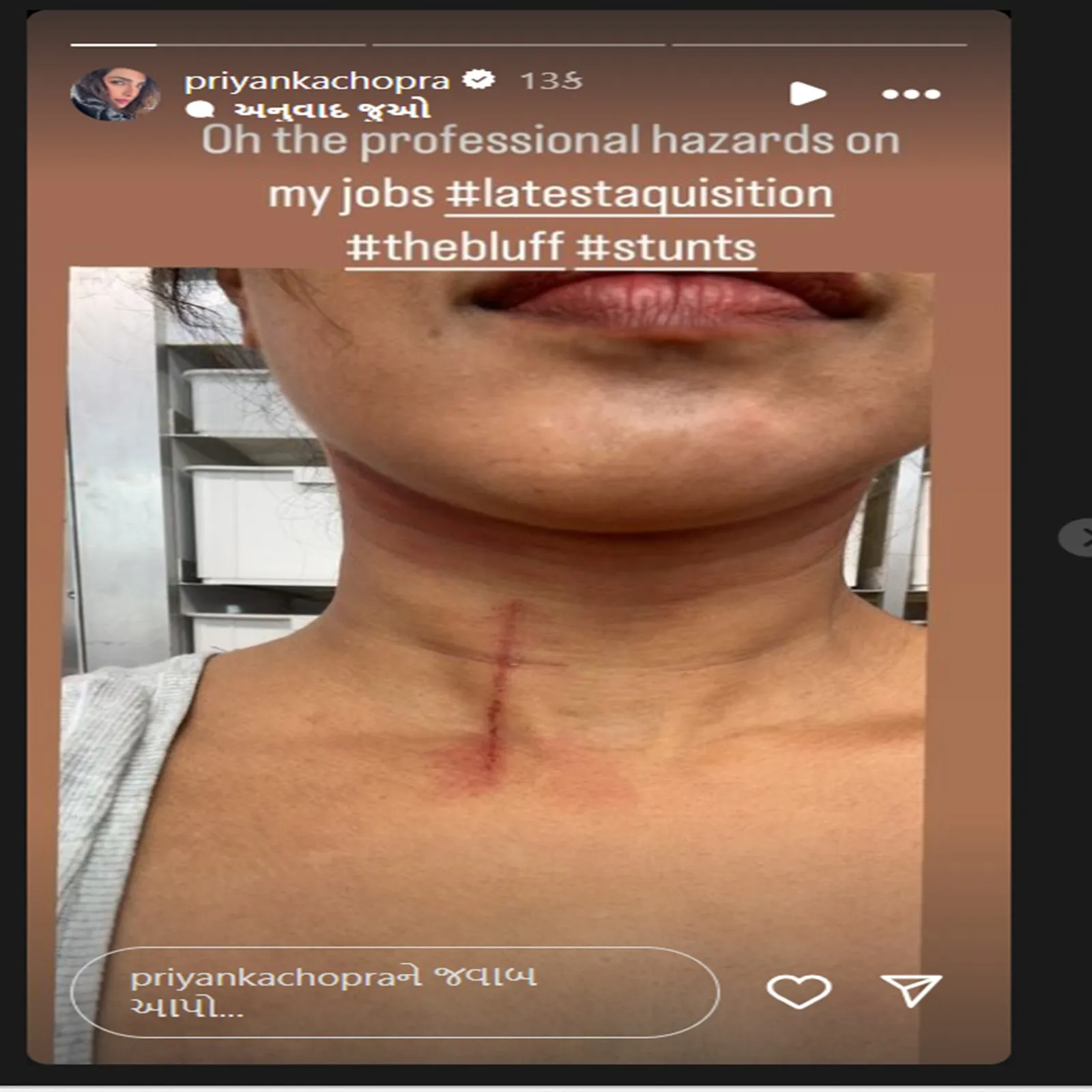 priyanka chopra | the bluff movie | priyanka chopra injury | priyanka chopra Instagram Story | priyanka chopra injured in the bluff