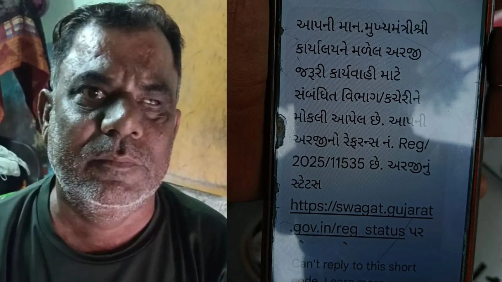 Eye Operation Failed, Shifa Multispecialty Hospital