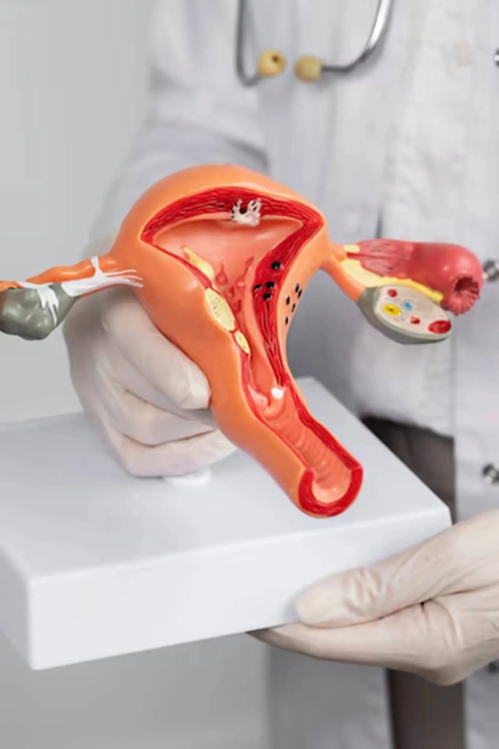 uterus