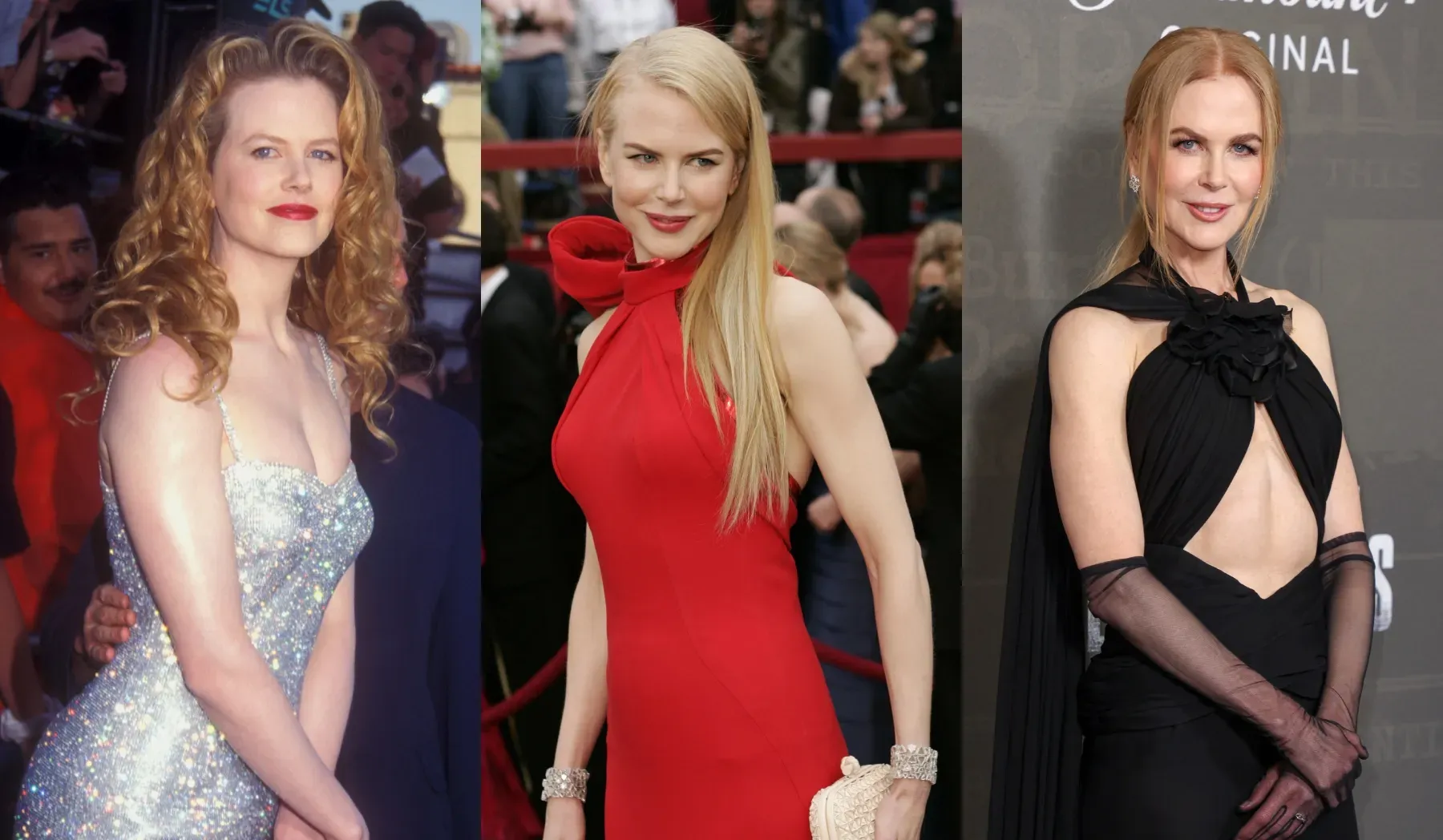 Nicole Kidman Botox